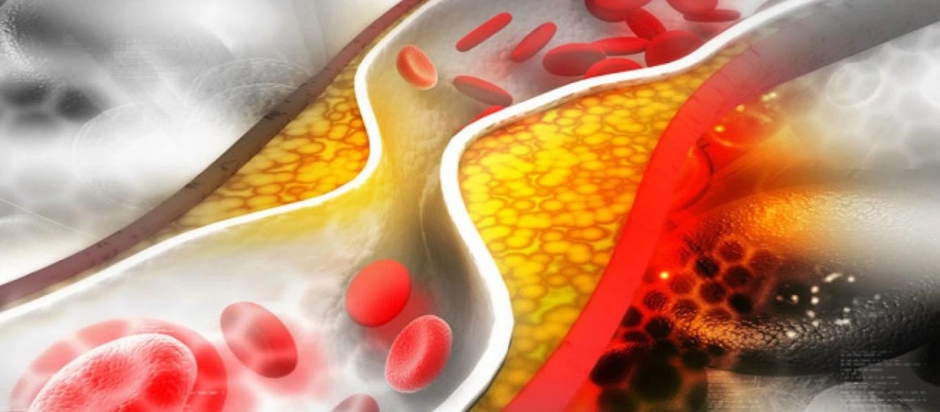 Οι 4+1 πιο κοινοί μύθοι για την χοληστερίνη